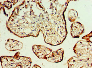 CSB-PA009443ESR2HU
