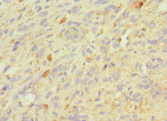 CSB-PA009939ESR2HU