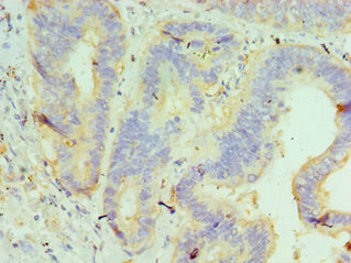CSB-PA010064ESR1HU