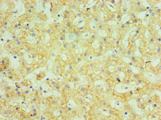 CSB-PA010064ESR1HU