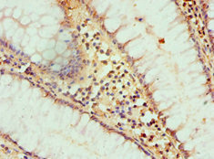 CSB-PA010143ESR2HU