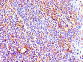 CSB-PA011652ESR1HU