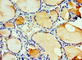 CSB-PA011652ESR1HU