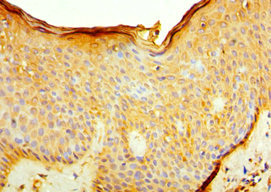 CSB-PA011670ESR1HU