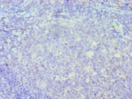 CSB-PA011823ESR1HU