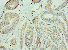 CSB-PA011829DSR1HU