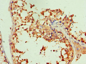 CSB-PA011885ESR1HU