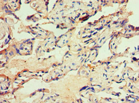 CSB-PA011885ESR1HU