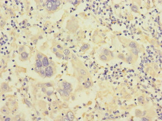 CSB-PA011891ESR1HU