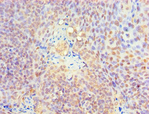 CSB-PA012394DSR2HU
