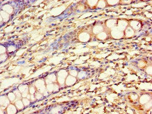 CSB-PA012394DSR2HU