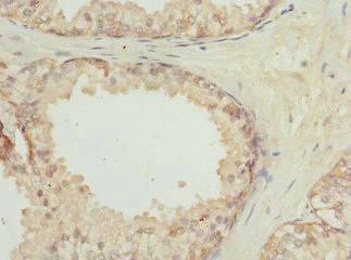 CSB-PA012894ESR2HU