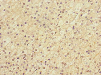 CSB-PA013099ESR1HU