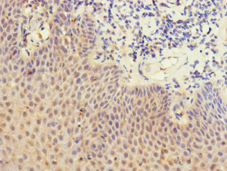CSB-PA013251ESR1HU