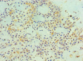 CSB-PA013323ESR2HU