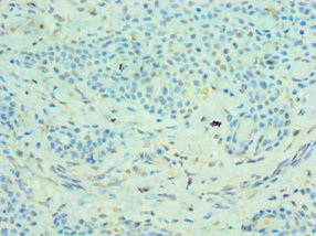 CSB-PA014661ESR1HU