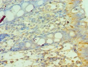 CSB-PA014661ESR1HU