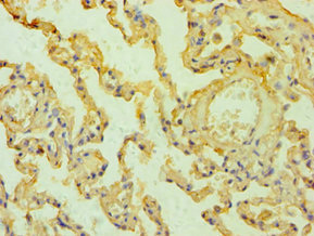CSB-PA015044ESR1HU