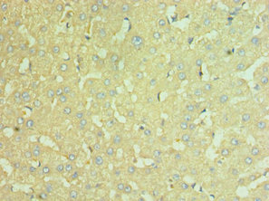 CSB-PA015422ESR2HU