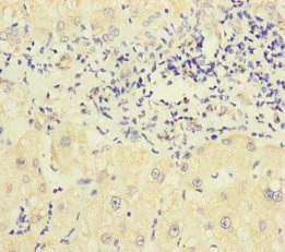 CSB-PA017321ESR1HU