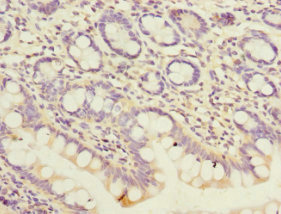 CSB-PA017802DSR2HU