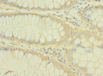 CSB-PA018223ESR1HU