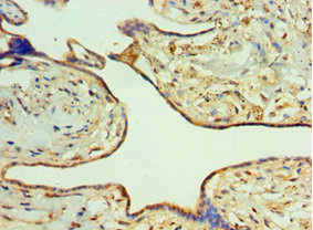CSB-PA019736ESR1HU