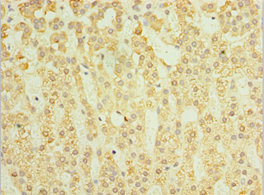CSB-PA021200ESR1HU