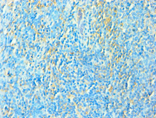 CSB-PA023429ESR1HU