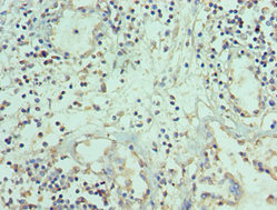 CSB-PA023987ESR1HU