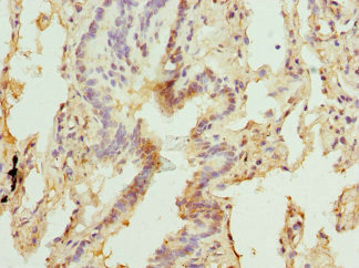 CSB-PA237035ESR2HU