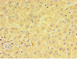 CSB-PA613493ESR2HU