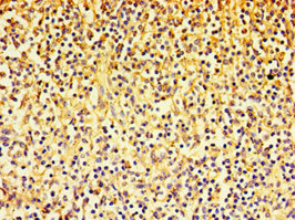 CSB-PA613493ESR2HU