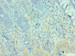 CSB-PA614418ESR1HU