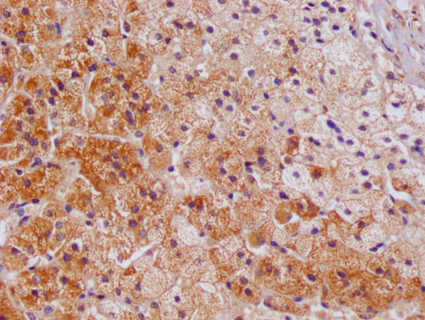 CSB-PA614985ESR1HU