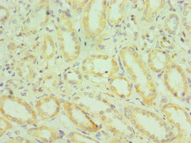 CSB-PA618635ESR2HU