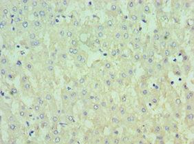 CSB-PA618901ESR1HU