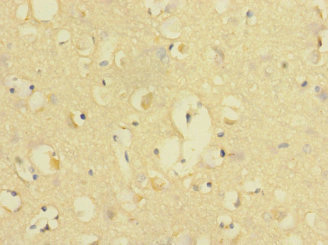 CSB-PA618996ESR2HU