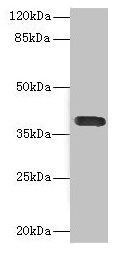 CSB-PA618996ESR2HU