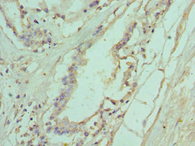 CSB-PA623927ESR1HU