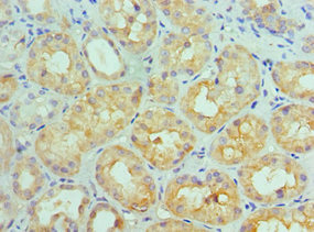 CSB-PA623927ESR1HU