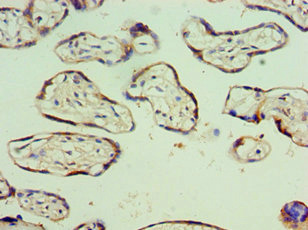 CSB-PA747778ESR1HU