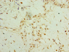 CSB-PA764560ESR1HU