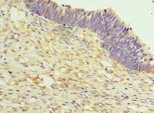 CSB-PA764560ESR1HU