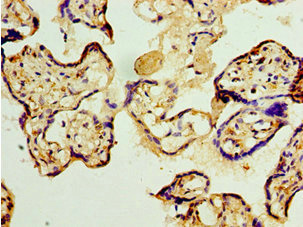 CSB-PA764560ESR1HU