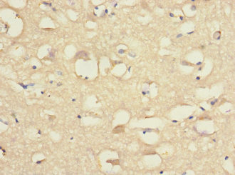 CSB-PA810284ESR2HU