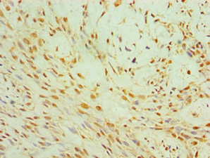 CSB-PA842636ESR1HU