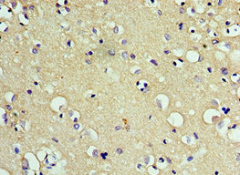 CSB-PA851547ESR1HU