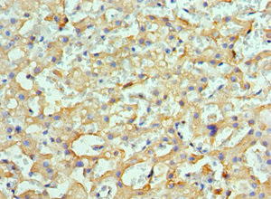 CSB-PA852885ESR1HU