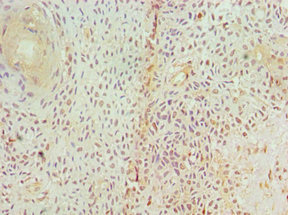 CSB-PA858702ESR1HU